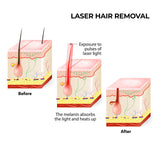 Xemos Laser Hair Remover W-808
